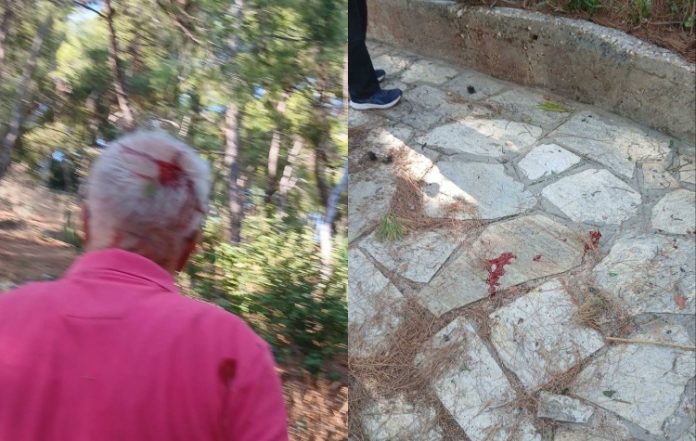 Δάφνη-Υμηττός: Τραυματισμός δημότη στο πάρκο Άρη Αλεξάνδρου / ΦΩΤΟ: Το forum των κατοίκων της Δάφνης